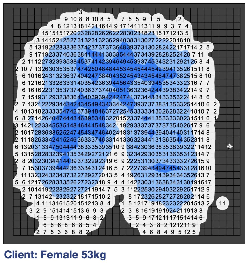 tlaková mapa (Pressure mapping) antidekubitnej sedačky Geo-Matrix Vinga